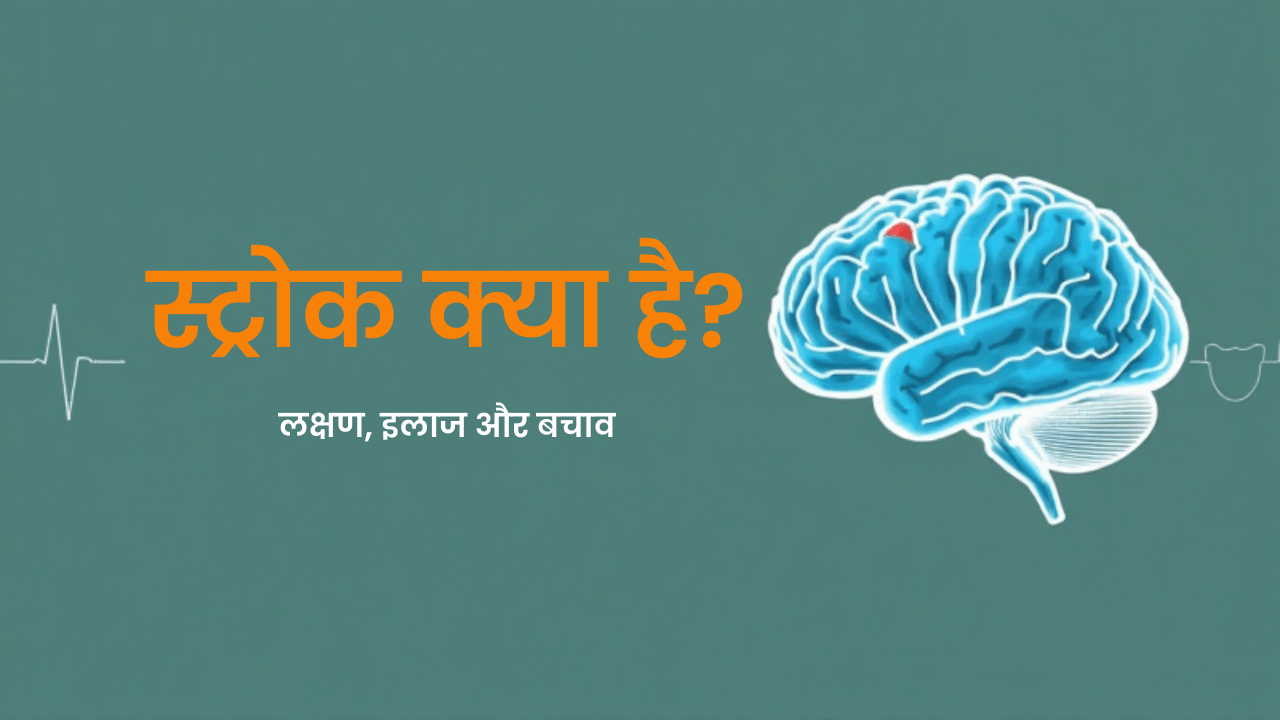 स्ट्रोक (लकवा) क्या है? लक्षण, इलाज और बचाव — एक पूरी जानकारी