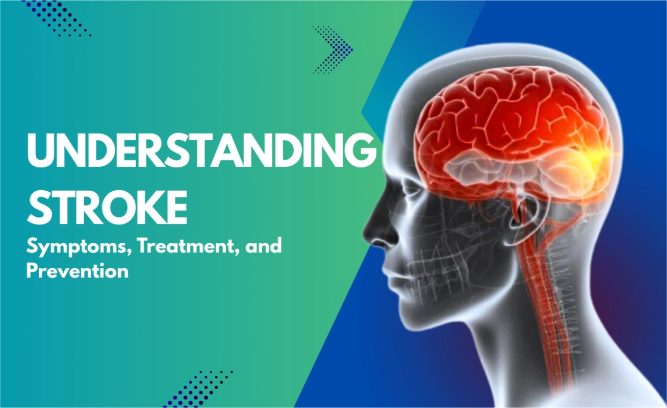 Understanding Stroke – Symptoms, Treatment, and Prevention